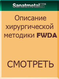 http://sanatmetal.ucoz.ua/instructions/FWDA.pdf