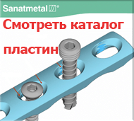 //sanatmetal.ucoz.ua/Trauma_Catalogue_Sanatmetal_Edition2011plates.pdf